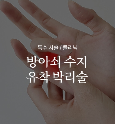 방아쇠 수지 유착 박리술